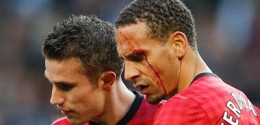 rio-ferdinand-cut-eye-vs-manchester-city